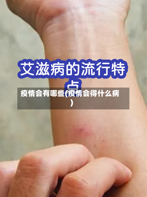 疫情会有哪些(疫情会得什么病)