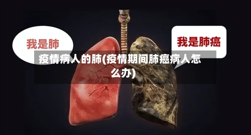 疫情病人的肺(疫情期间肺癌病人怎么办)-第2张图片
